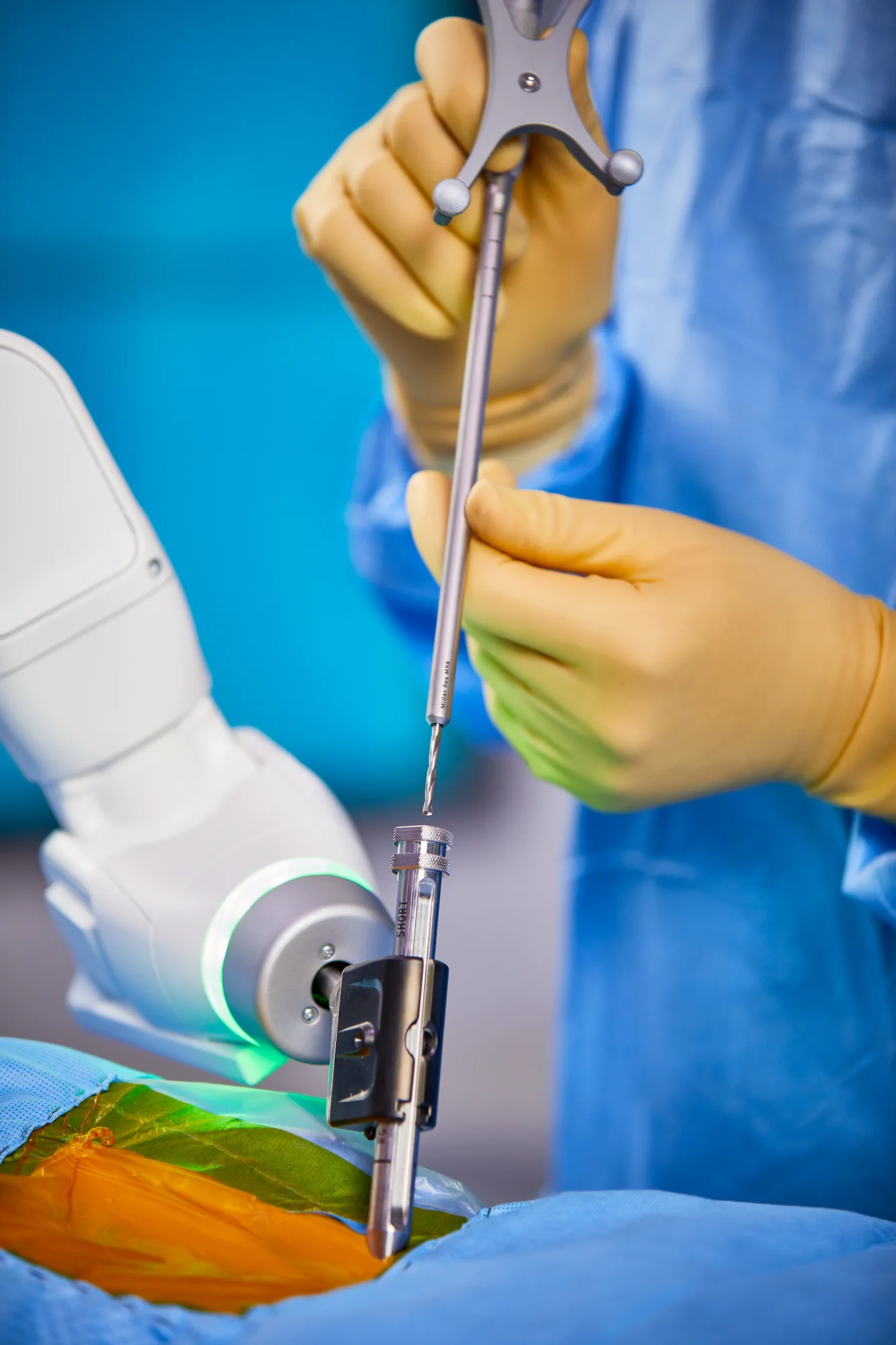 Close-up of the Medtronic Mazor robotic arm holding a guide on the planned path while the surgeon passes a navigated drill through it