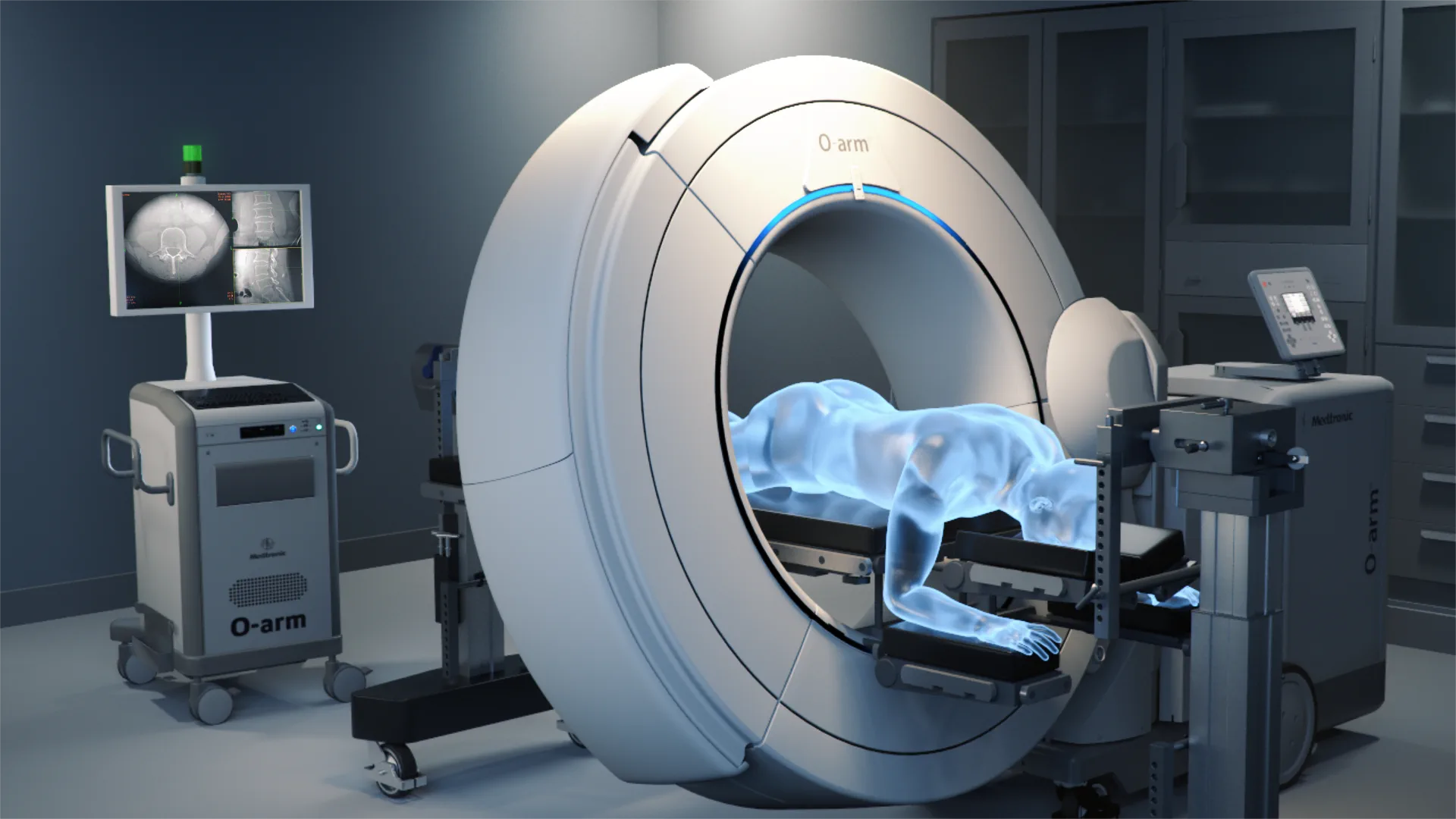 Rendering of a patient lying face down inside the Medtronic O-arm for a CT scan during surgery, with the O-arm's display cart beside it